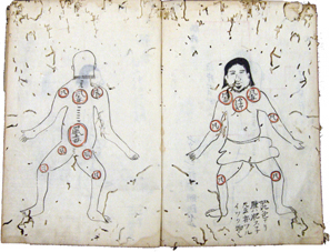 東西の古医書に見られる病と治療 - 附属図書館の貴重書